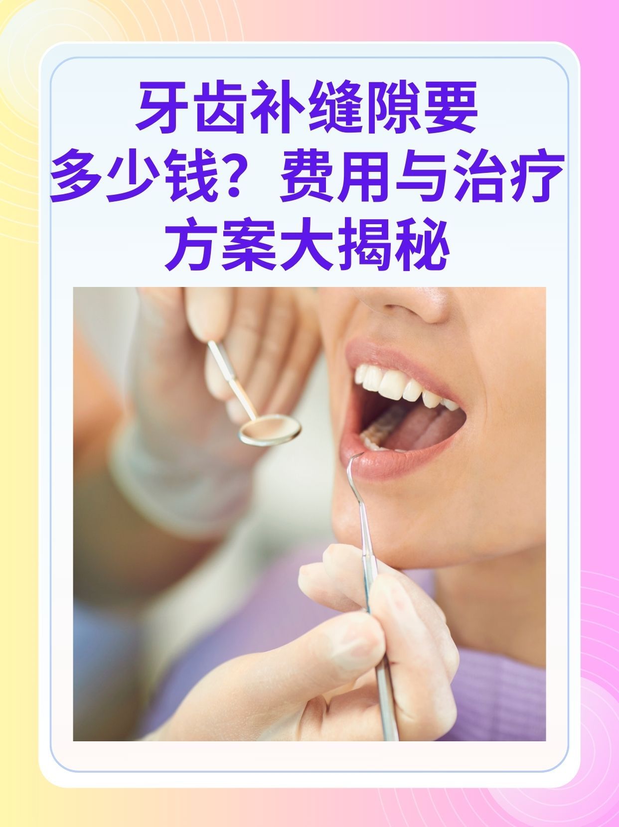 兰州补牙医保可以报销吗(补牙医保可以报销吗 哪些可以报销呢)